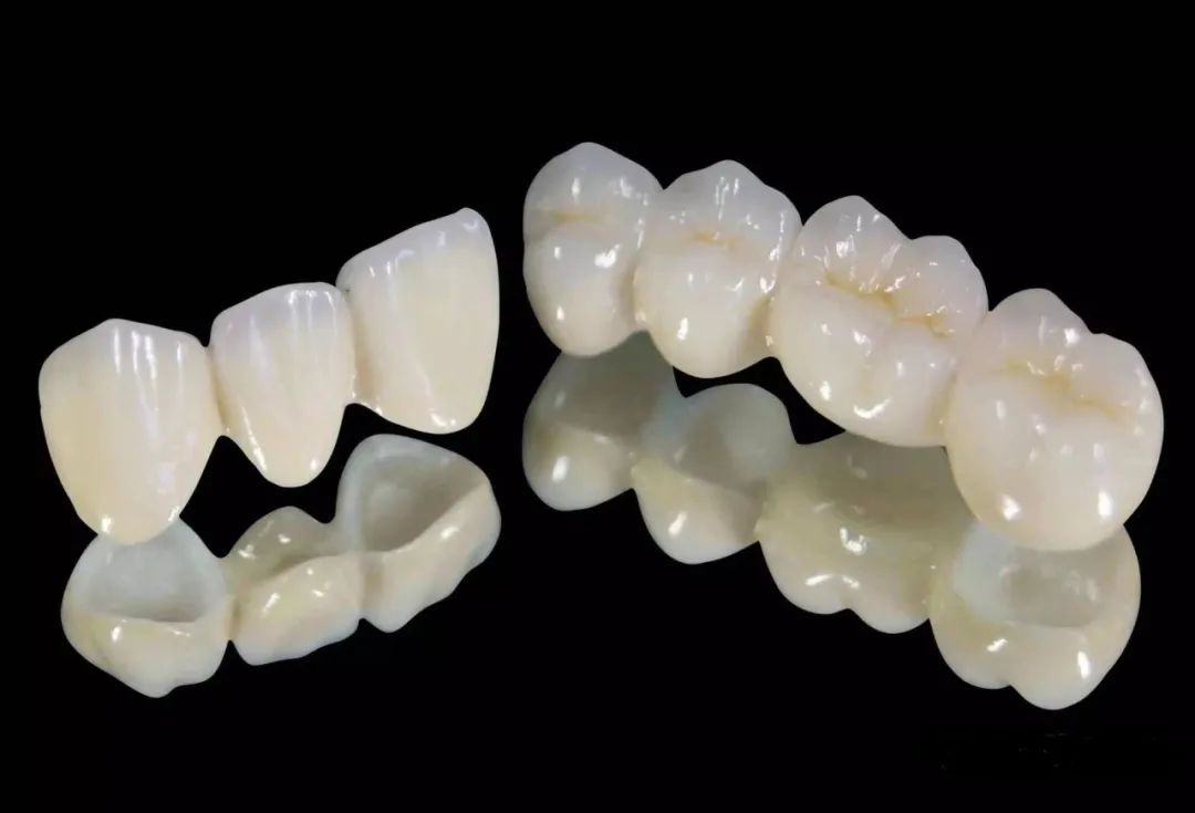为什么牙医们都推荐Aidite全瓷牙？它有这么好吗？
